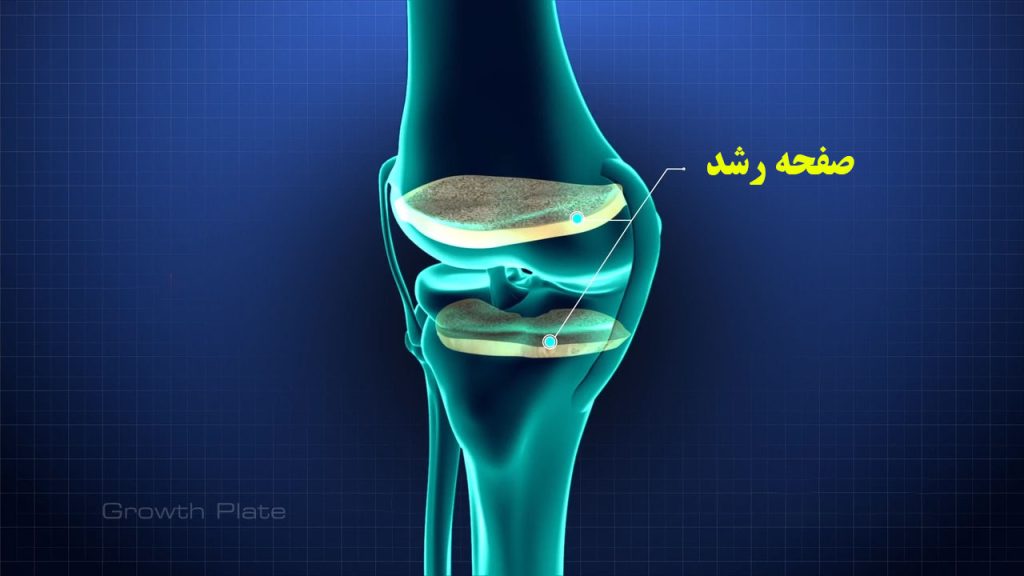 چه عواملی باعث بسته شدن صفحه رشد میشود