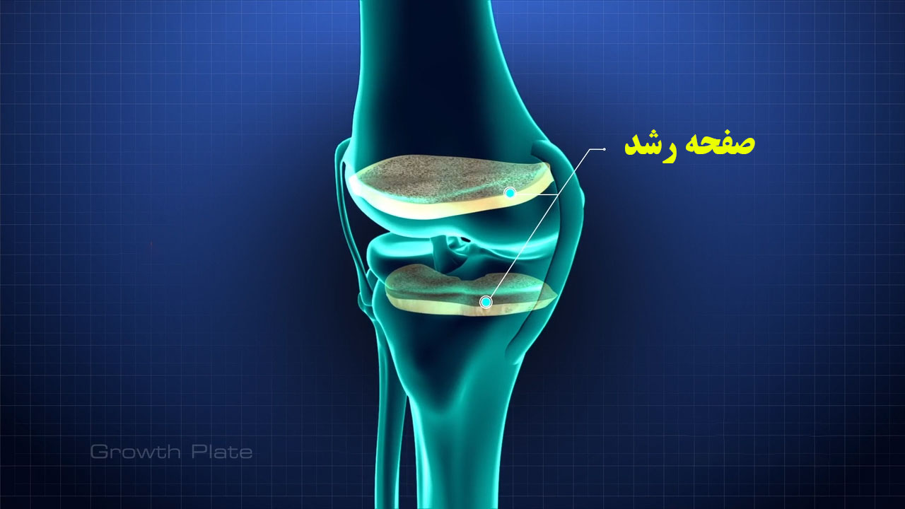چه عواملی باعث بسته شدن صفحه رشد میشود